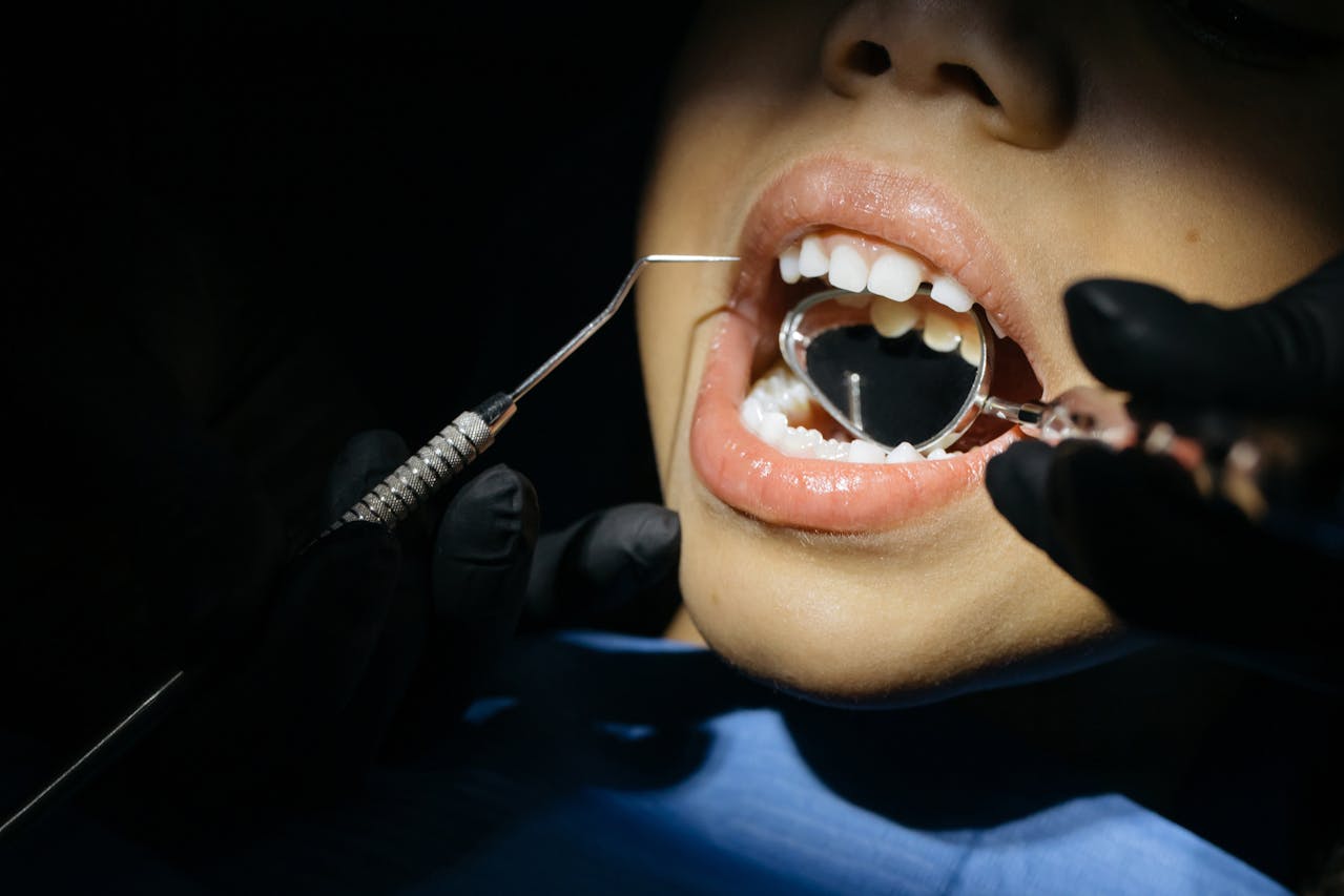 Preventing Cavities in Children: Tips for Parents