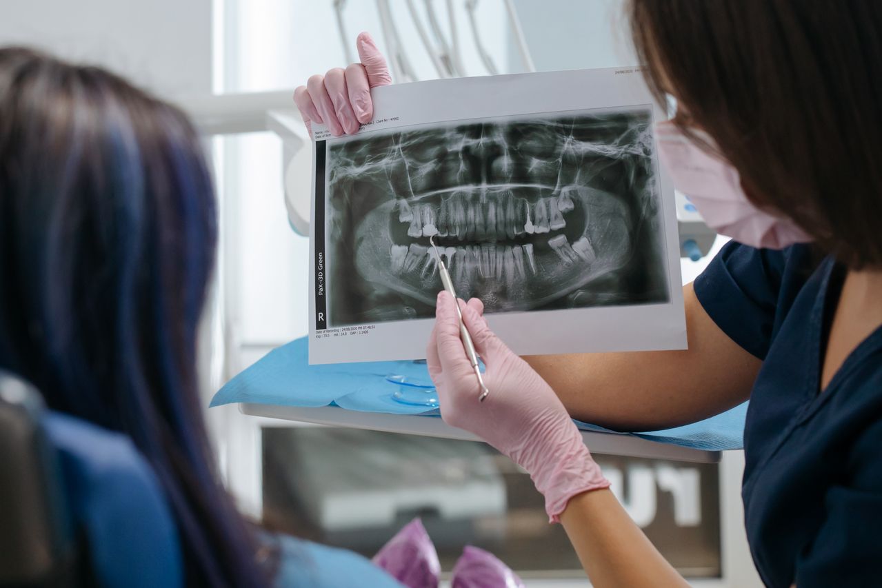 Dental X-Rays: Are They Safe and Why Are They Needed?