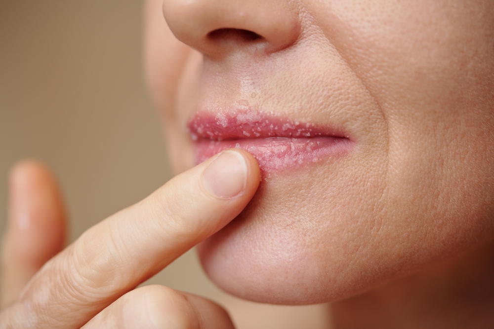 Dry Winter Air and Oral Health
