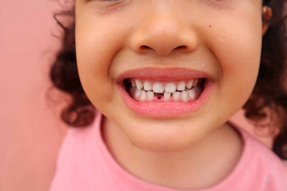What to Do When Your Child Knocks Out a Tooth?