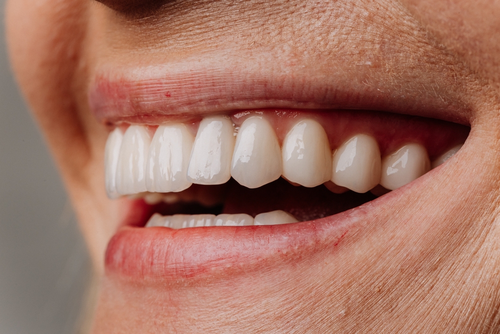 Revitalizing an Aging Smile: Cosmetic and Restorative Options for Seniors
