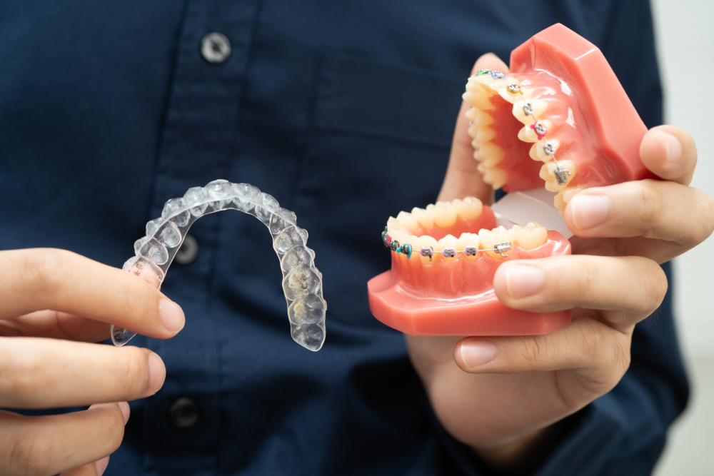 Orthodontic provider holding a clear aligner next to a dental model with metal braces in Windsor.
